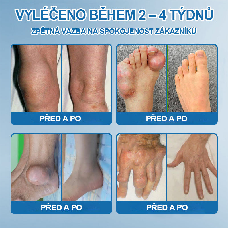 💎 Poslední den akce 80% SLEVA |  CleraNaure® BPC-157 Krém na hojení kloubů🦴Léčí artritidu, neuropatii, revmatismus, sportovní úrazy a další