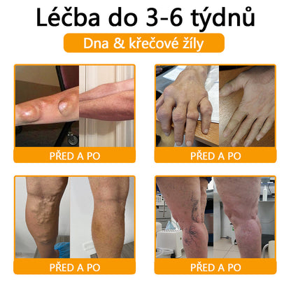 🫧CleraNaure® Krém s včelím jedem pro úlevu od bolesti a hojení kostí