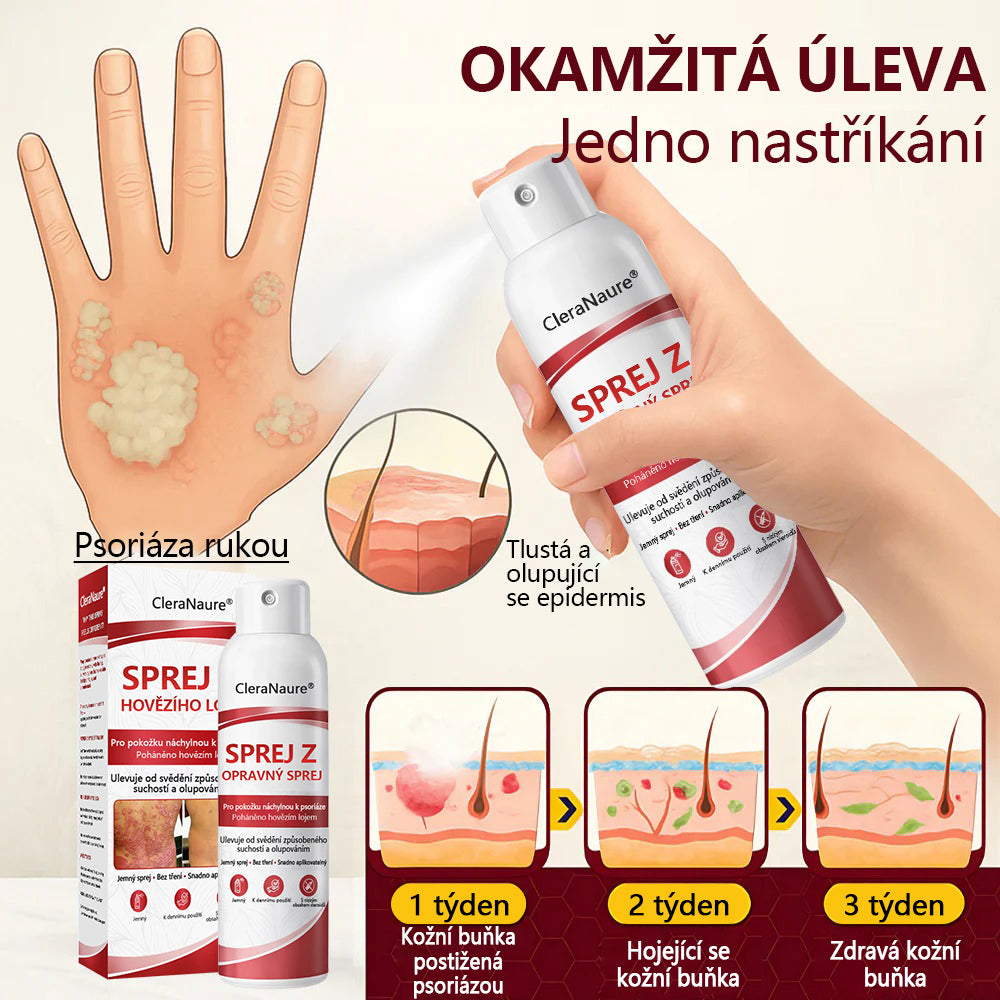 CleraNature® Sprej s Hovězím Tvarohem pro Svědící, Olupující se Pokožku Při Psoriáze