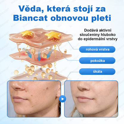 CleraNaure® MicroHydro 2v1 mikrojéhlová náplast