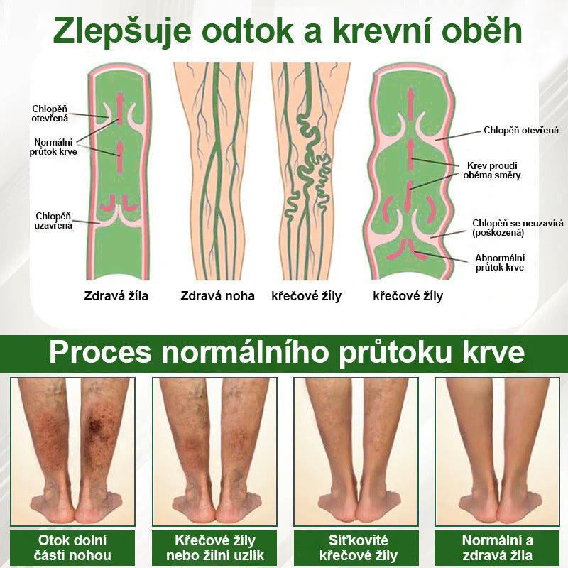 🌿Buzora® Bylinný krém zmírňující otoky s černuchou🎁