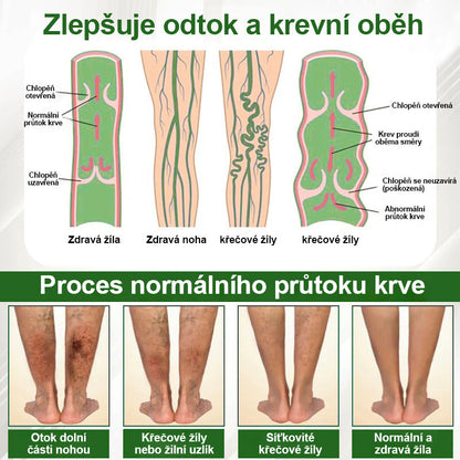 🌿Buzora® Bylinný krém zmírňující otoky s černuchou🎁