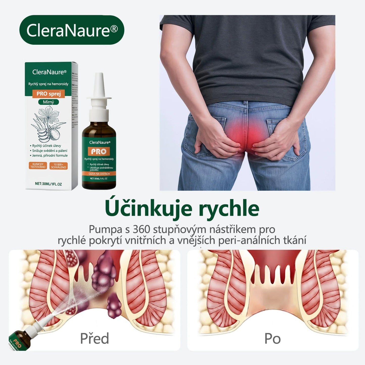 🥇CleraNaure® Rychlý Hemoroidní PRO Sprej🛡️