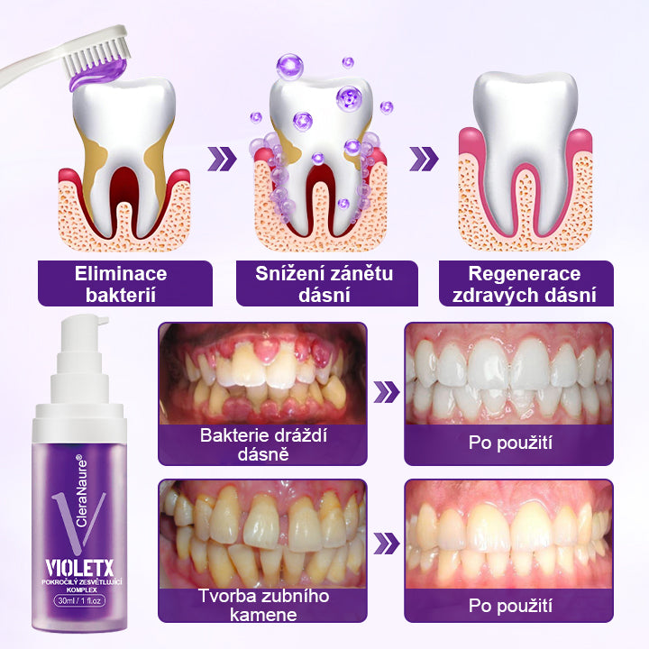 CleraNaure® VioletX – pokročilý bělicí komplex