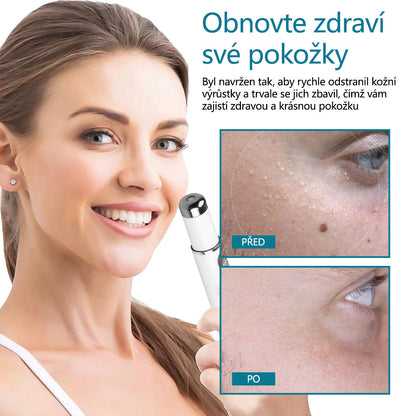 DAFEILA® LumeSkin – laserové pero pro odstraňování znamének a bradavic