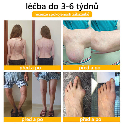 🛡️CleraNaure® Krém s včelím jedem pro úlevu od bolesti a hojení kostí