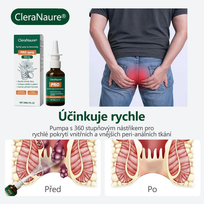 💎CleraNaure® Rychlý Hemoroidní PRO Sprej🍀
