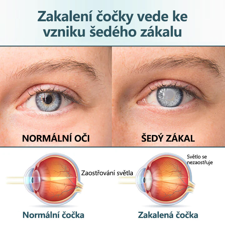 ✨CleraNaure® Optifusion Nano Kapky pro Oči Sérum