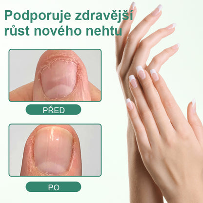 CleraNaure® Nail Detox – penetrační sérové pero na nehty