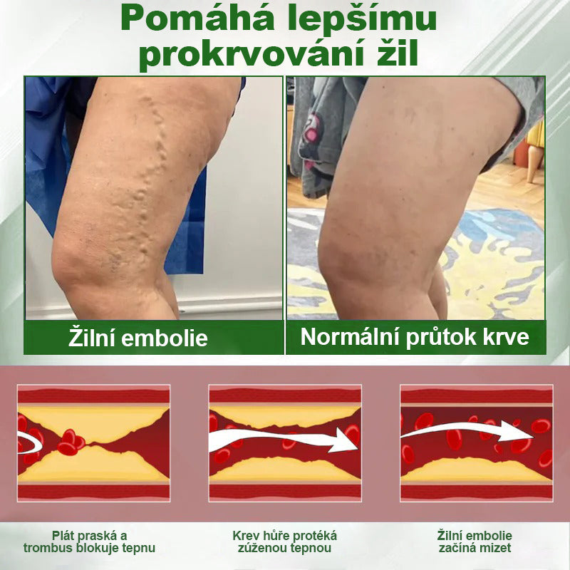 🌿Buzora® Bylinný krém zmírňující otoky s černuchou🎁