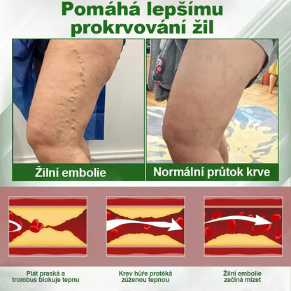 🌿Buzora® Bylinný krém zmírňující otoky s černuchou🎁