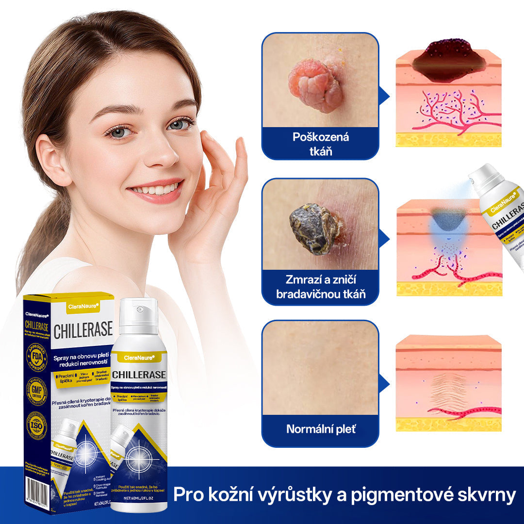 ✨CleraNaure® ChillErase sprej na obnovu hrbolků✨