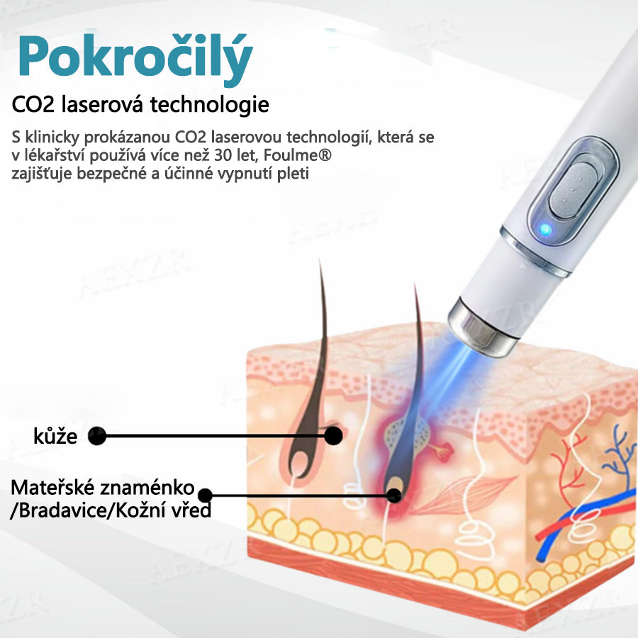 CleraNaure® PRO Neinvazivní laserové pero na odstraňování bradavic a znamének