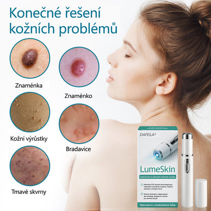 DAFEILA® LumeSkin – laserové pero pro odstraňování znamének a bradavic